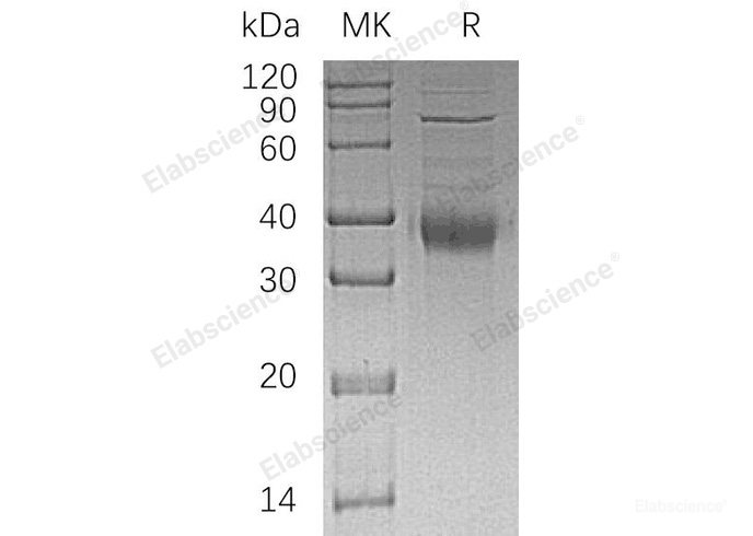 Recombinant Human KIR2DL4/CD158d/KIR103 Protein(C-6His)-Elabscience