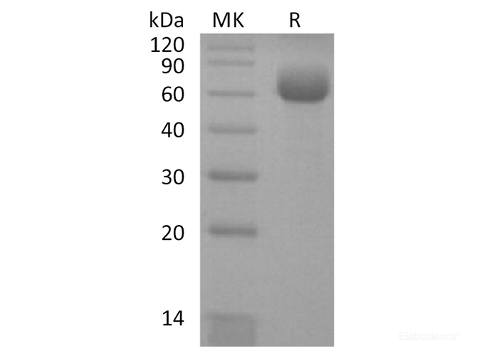 Recombinant Human KLRB1/CD161 Protein(C-Fc)-Elabscience