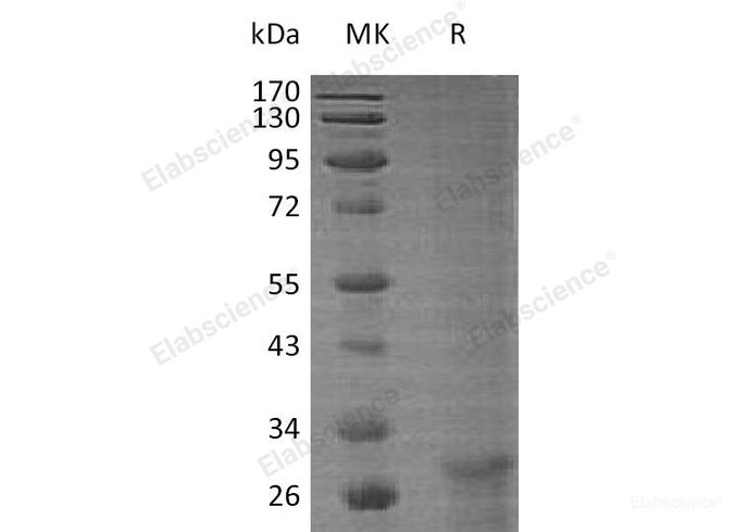 Recombinant Human Krueppel-Like Factor 6/KLF6 Protein-Elabscience