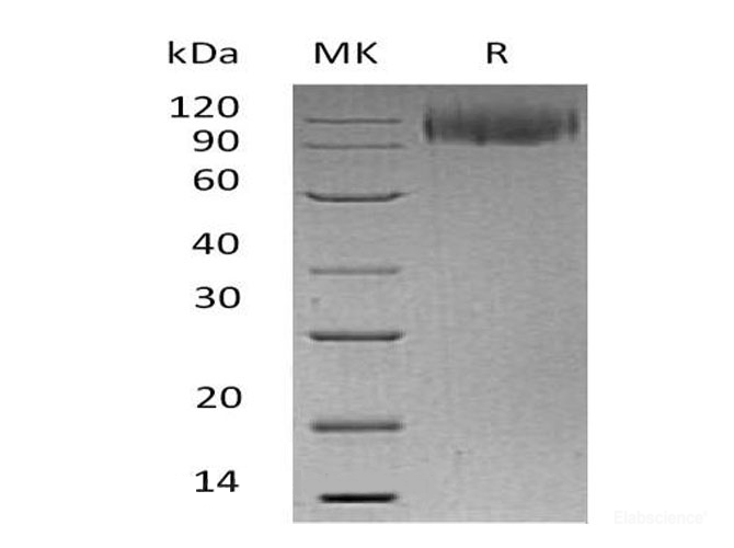 Recombinant Human LAMP1/CD107a Protein(C-Fc)-Elabscience