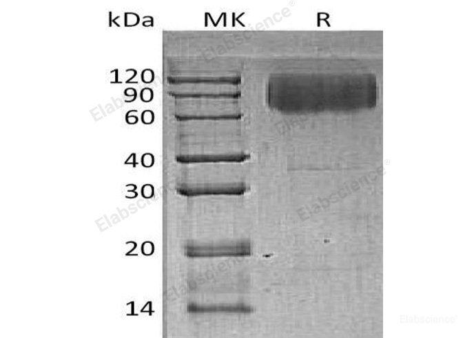 Recombinant Human LAMP2/CD107b Protein(C-6His)-Elabscience