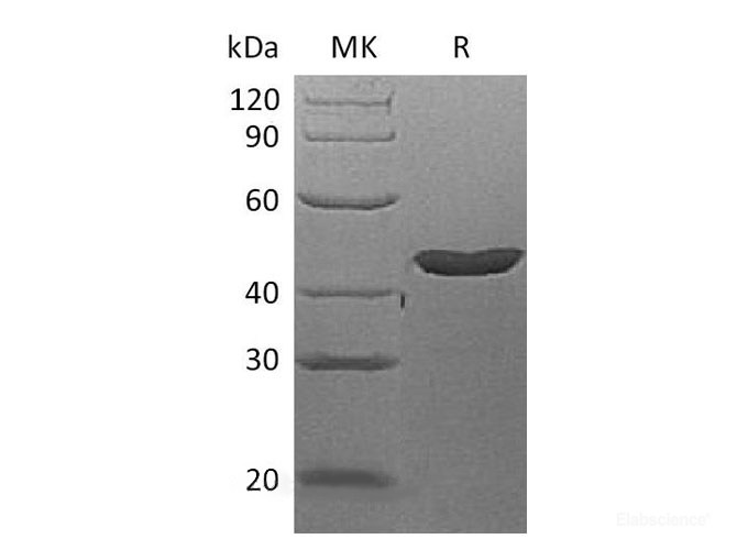 Recombinant Human Left-right Determination Factor 2 Protein(N-6His)-Elabscience