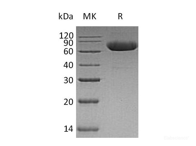 Recombinant Human Leucine-Rich Repeat-Containing Protein 2/LRRN2 Protein(C-6His)-Elabscience