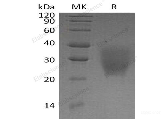 Recombinant Human Leucine-Rich Repeat-Containing Protein 25/LRRC25 Protein(C-6His)-Elabscience
