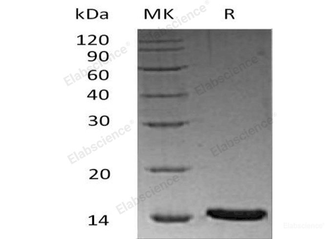 Recombinant Human Leucine-Rich Repeat-Containing Protein 3B/LRRC3B Protein(C-6His)-Elabscience