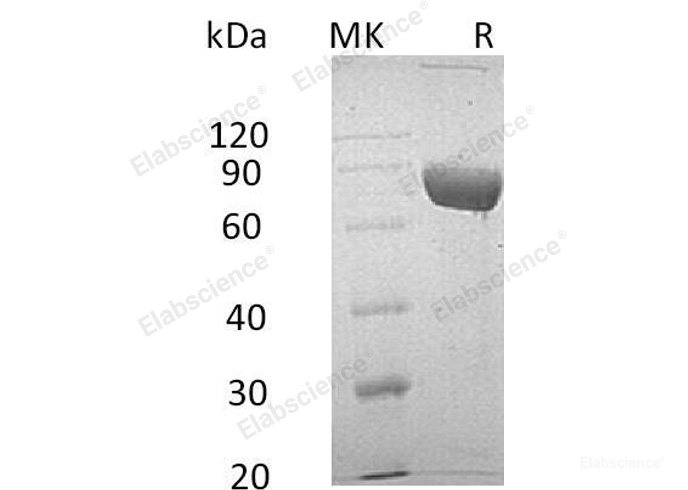 Recombinant Human Leucine-Rich α-2-Glycoprotein/LRG1 Protein(C-Fc-6His)-Elabscience
