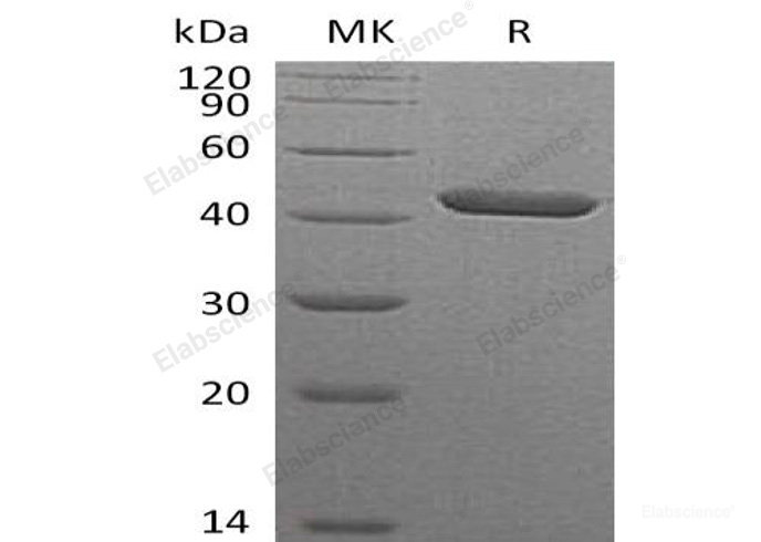 Recombinant Human Leukocyte Elastase Inhibitor/Serpin B1/SERPINB1 Protein(C-6His)-Elabscience