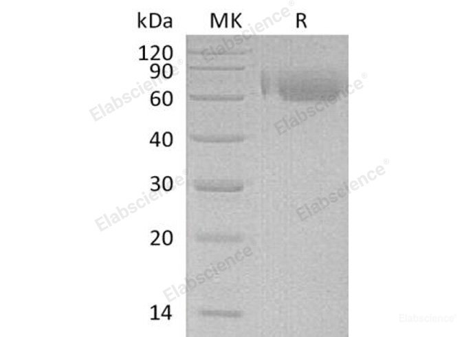 Recombinant Human Leukocyte Ig-Like Receptor A2/LILRA2/ILT1/CD85h Protein(C-6His)-Elabscience