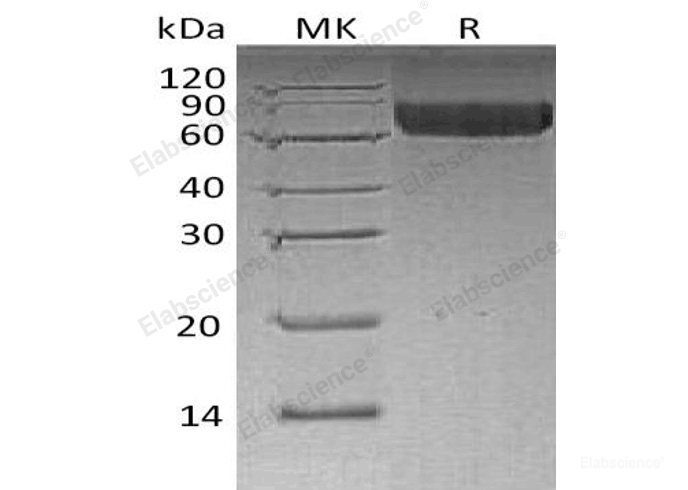 Recombinant Human Leukocyte Ig-Like Receptor B2/LILRB2/ILT4/CD85d Protein(C-6His)-Elabscience