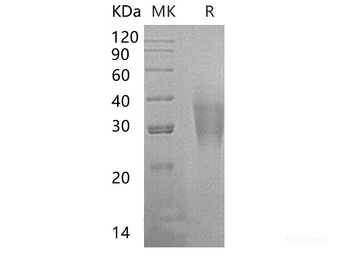 Recombinant Human Leukocyte Mono Ig-Like Receptor 1/LMIR1/CD300a Protein(C-6His)-Elabscience