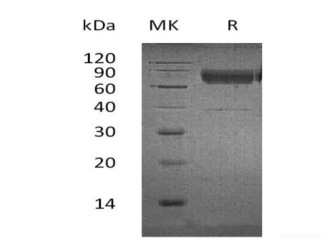 Recombinant Human Leukocyte Mono Ig-Like Receptor 1/LMIR1/CD300a Protein(C-Fc-6His)-Elabscience