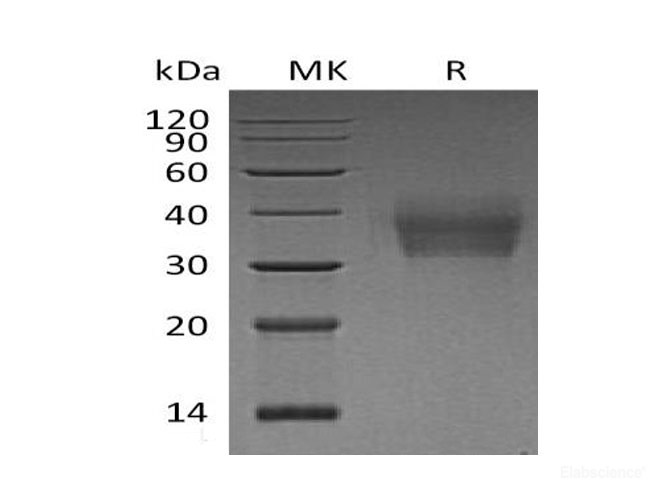 Recombinant Human Leukocyte Mono Ig-Like Receptor 2/LMIR2/CD300C Protein(C-6His)-Elabscience