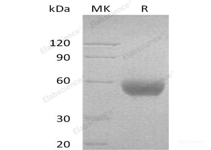 Recombinant Human Leukocyte Surface Antigen CD47/IAP/OA3 Protein(C-Fc)-Elabscience