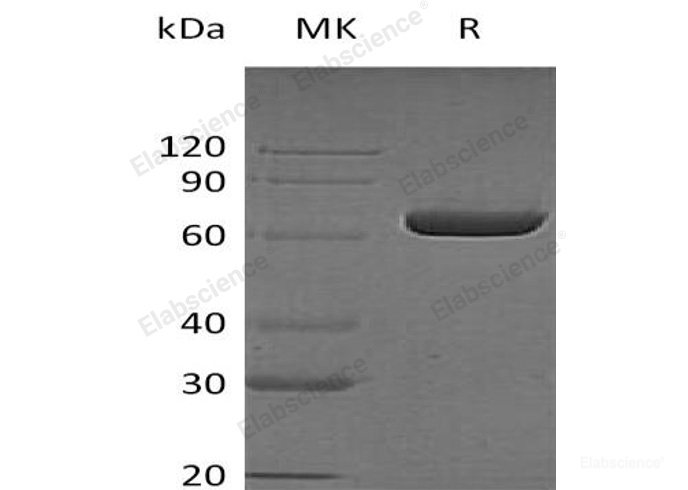 Recombinant Human Leukotriene A-4 Hydrolase/LTA4H Protein(C-6His)-Elabscience