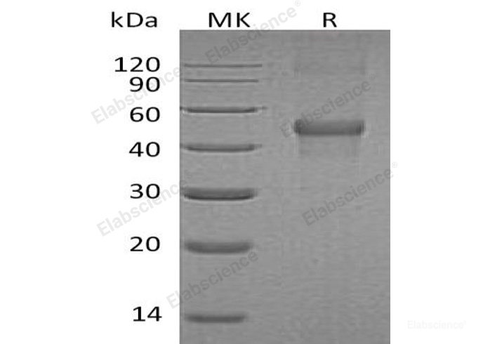 Recombinant Human LIM and Cysteine-Rich Domains Protein 1/LMCD1/Dyxin Protein(N, C-6His)-Elabscience