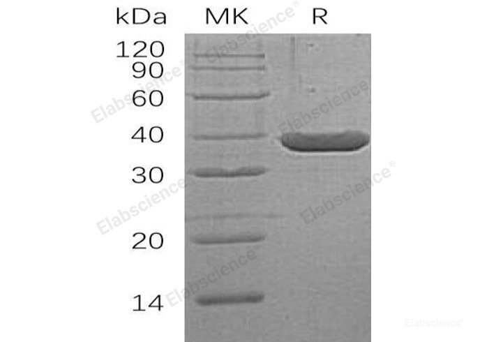 Recombinant Human L-Lactate Dehydrogenase A Chain/LDH-A/PIG19 Protein(N-6His)-Elabscience