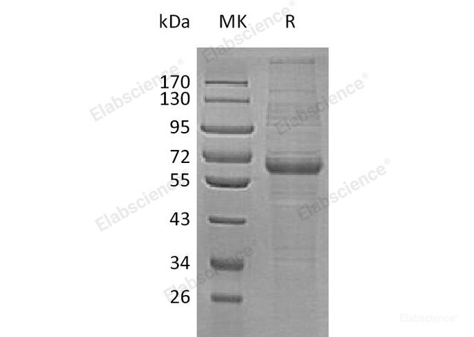 Recombinant Human Low-Density Lipoprotein Receptor Related Protein 12/LRP12 Protein(C-6His)-Elabscience