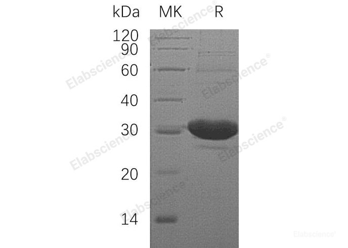 Recombinant Human L-Xylulose Reductase/DCXR Protein(N-6His)-Elabscience