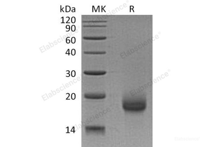 Recombinant Human Lymphocyte Antigen 6H/LY6H Protein(C-6His)-Elabscience