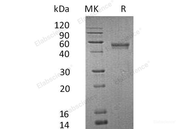 Recombinant Human Lymphotactin/LTN/XCL1 Protein(C-Fc-6His)-Elabscience