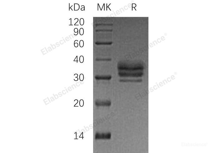 Recombinant Human Lymphotoxin β R/LTBR/TNFRSF3/TNFRrpv Protein(C-6His)-Elabscience