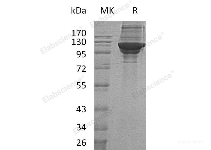 Recombinant Human Lysine--tRNA Ligase/KARS Protein(C-6His)-Elabscience