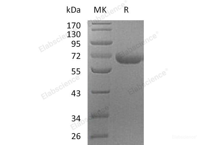 Recombinant Human Lysosomal Pro-X Carboxypeptidase/PRCP Protein(C-6His)-Elabscience
