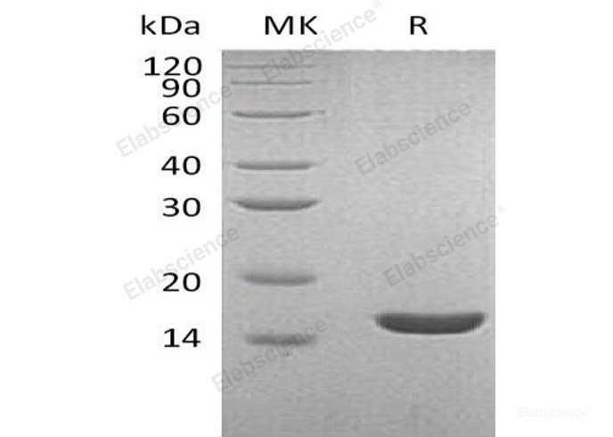 Recombinant Human Lysozyme C/LYZ Protein(C-6His)-Elabscience