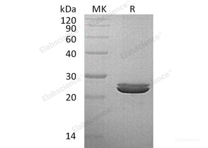 Recombinant Human Lysozyme G-Like Protein 2/LYG2 Protein(C-6His)-Elabscience