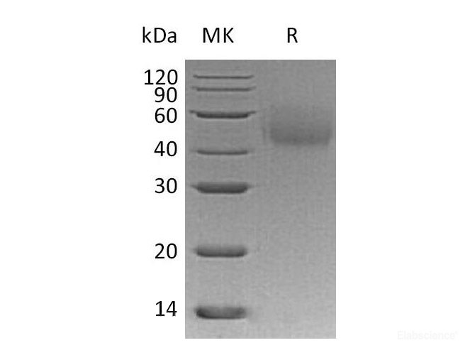 Recombinant Human LYVE-1/HAR/XLKD1 Protein(C-6His)-Elabscience