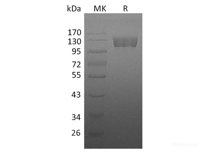Recombinant Human Macrophage Colony-stim. Factor 1 Receptor/M-CSF R/CSF1R/CD115 Protein(C-Fc)-Elabscience