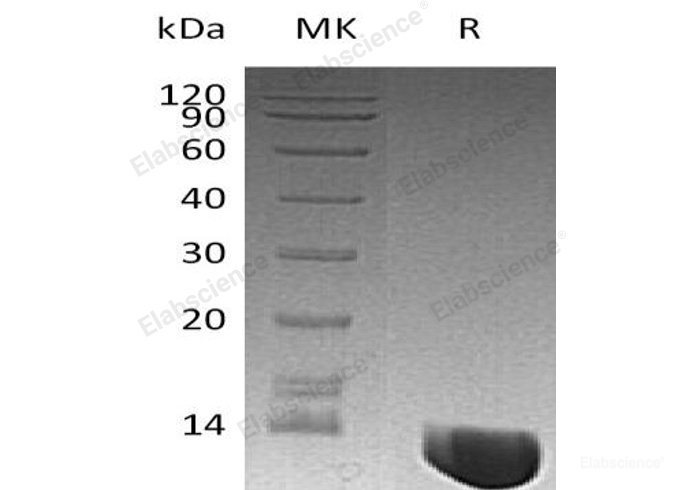 Recombinant Human Macrophage Migration Inhibitory Factor/MIF Protein-Elabscience