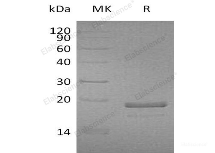 Recombinant Human Magnesium-Dependent Phosphatase 1/MDP1 Protein(C-6His)-Elabscience