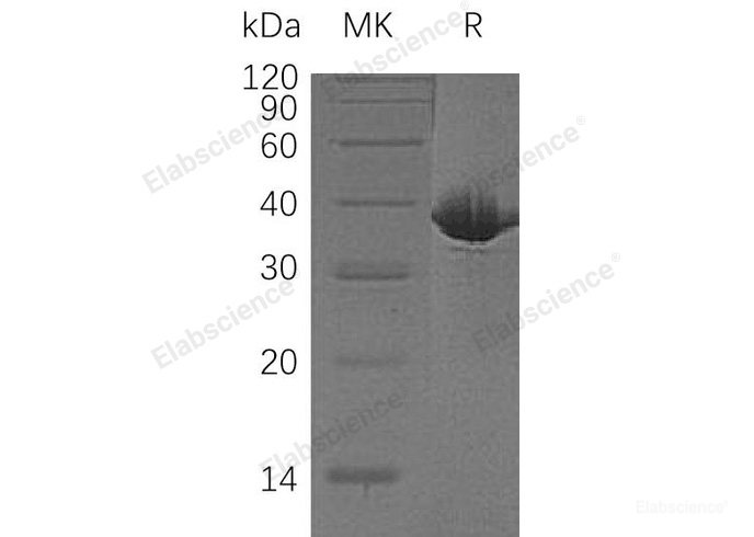 Recombinant Human Malate Dehydrogenase, Cytoplasmic/MDH1 Protein(C-6His)-Elabscience