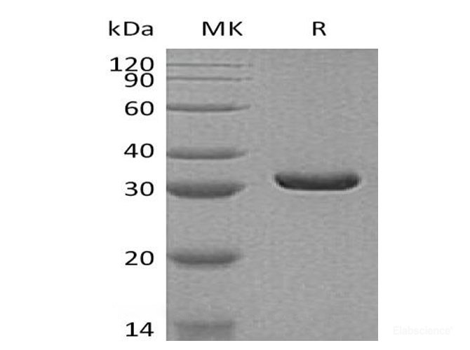 Recombinant Human Malate Dehydrogenase, Mitochondrial/MDH2 Protein(C-6His)-Elabscience