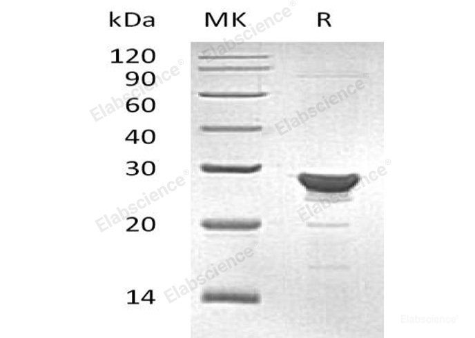 Recombinant Human Maleylacetoacetate Isomerase/MAA/GSTZ1 Protein(C-6His)-Elabscience