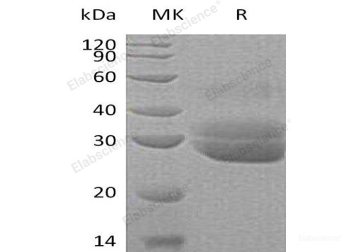 Recombinant Human Mammalian Ependymin-Related Protein 1/EPDR1/UCC1 Protein(C-6His)-Elabscience