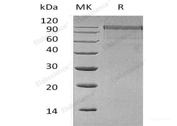 Recombinant Human Mannan-Binding Lectin Serine Protease 1/MASP1 Protein(C-6His)-Elabscience