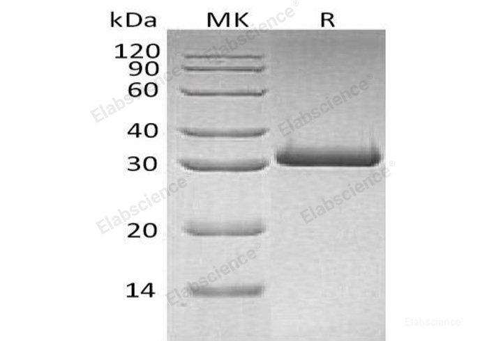Recombinant Human Mannose-Binding Protein C/MBL-2/MBP- C Protein(C-6His)-Elabscience
