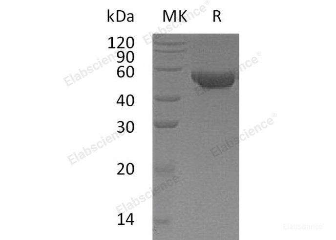 Recombinant Human Mannoside Acetylglucosaminyltransferase 2/GlcNAc-TII Protein(C-6His)-Elabscience