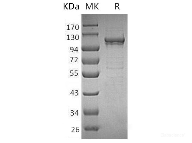 Recombinant Human MANSC Domain-Containing Protein 1/MANSC1 Protein(C-6His)-Elabscience