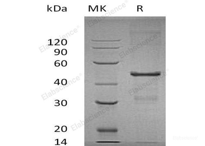 Recombinant Human MAP3K12-Binding Inhibitory Protein 1/MBIPP Protein(N-6His)-Elabscience
