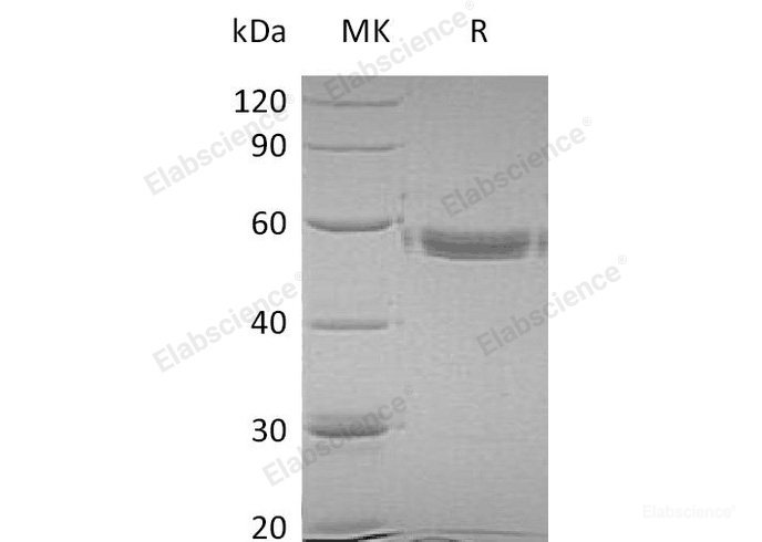 Recombinant Human Matrix Metalloproteinase-1/MMP-1 Protein(C-6His)-Elabscience