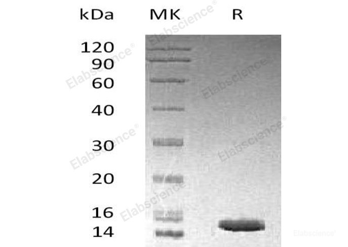 Recombinant Human MEK-Binding Protein 1/MP1/MAPKSP1 Protein(N-6His)-Elabscience