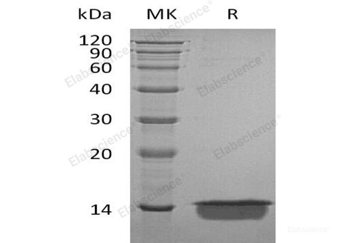 Recombinant Human Melanoma Inhibitory Activity Protein/MIA Protein(C-6His)-Elabscience