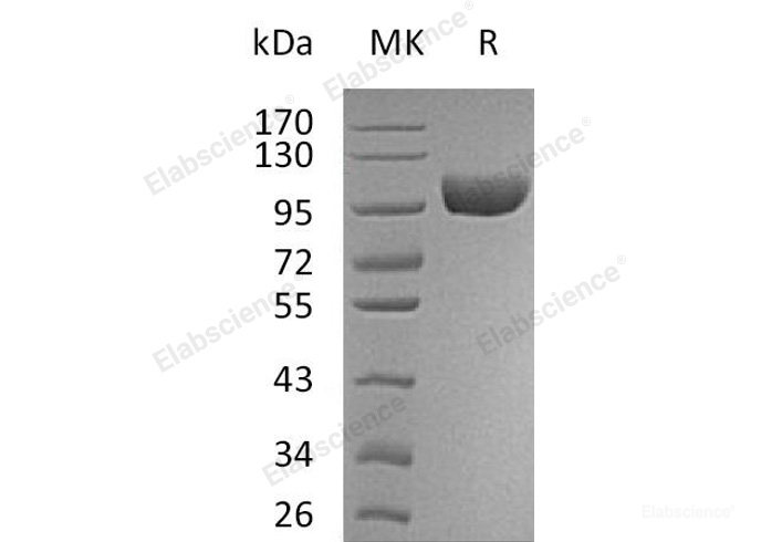 Recombinant Human Membrane Primary Amine Oxidase/AOC3 Protein(C-6His)-Elabscience