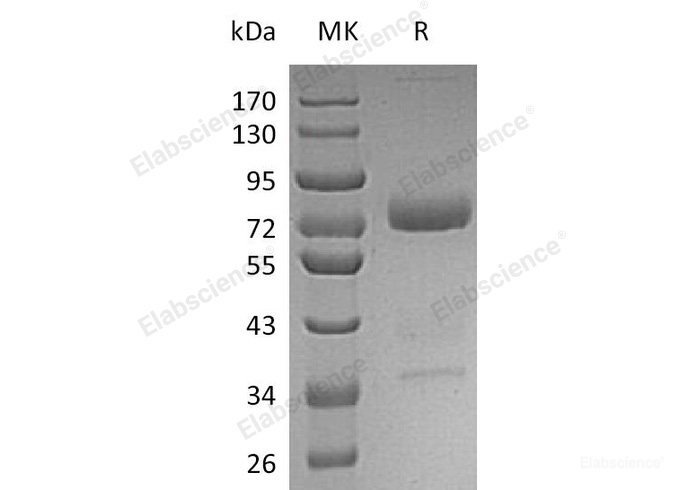Recombinant Human Mesothelin Protein(C-Fc)-Elabscience