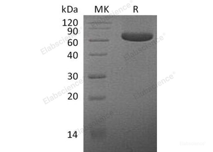 Recombinant Human Mesothelin/MSLN/CAK1/MPF Protein(C-Fc)-Elabscience
