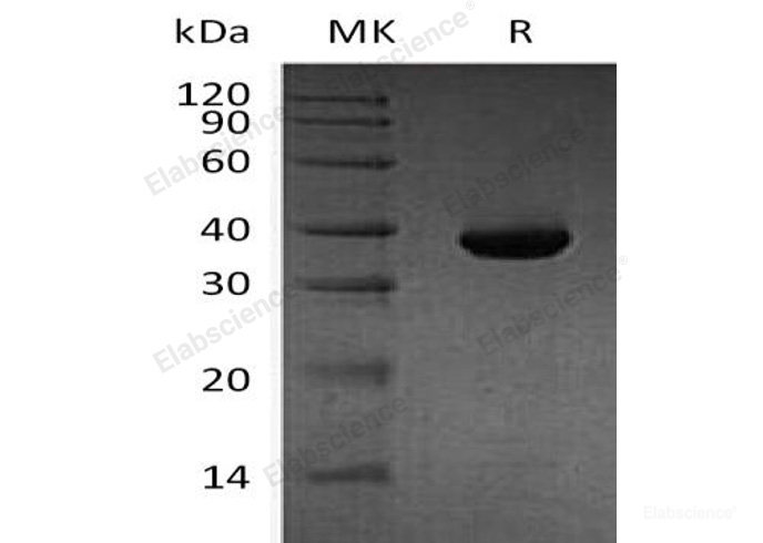 Recombinant Human Methionine Aminopeptidase 1D/MetAP1D/MAP1D Protein(N, C-6His)-Elabscience