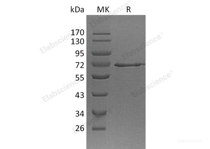 Recombinant Human Methionine Aminopeptidase 2/METAP2 Protein(N-6His)-Elabscience